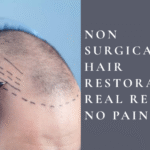non surgical hair restoration