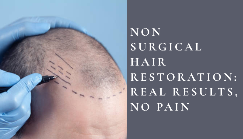 non surgical hair restoration