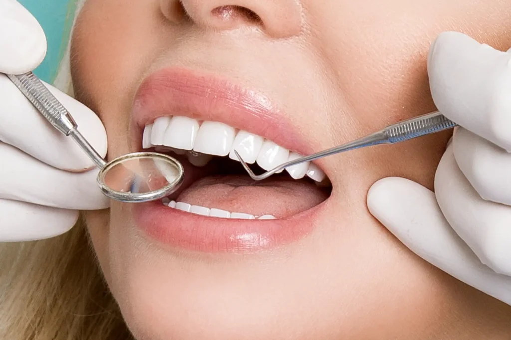Which Treatments Improve Teeth Aesthetics Quickly?