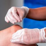 Discover Holistic Healing with Physiotherapy and Acupuncture in Calgary