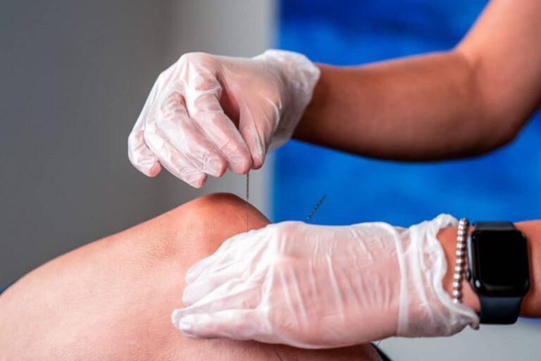 Discover Holistic Healing with Physiotherapy and Acupuncture in Calgary
