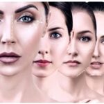 Enhance Your Facial Features with Facelift Surgery