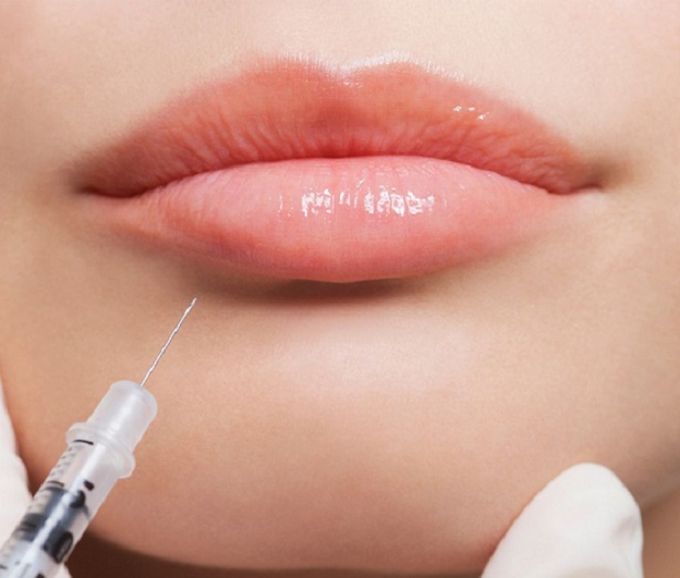 Lip Botox: Painless and Quick Cosmetic Boost