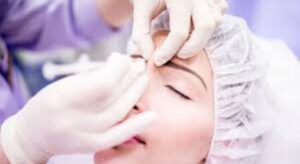 derma filler treatments images
