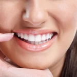images_blog_2013_emax-veneers