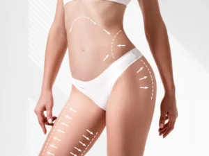 Fat transfer in dubai