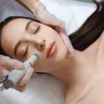 Best treatment for undereyes Chicago