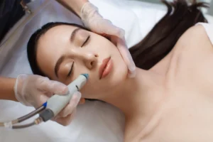 Best treatment for undereyes Chicago