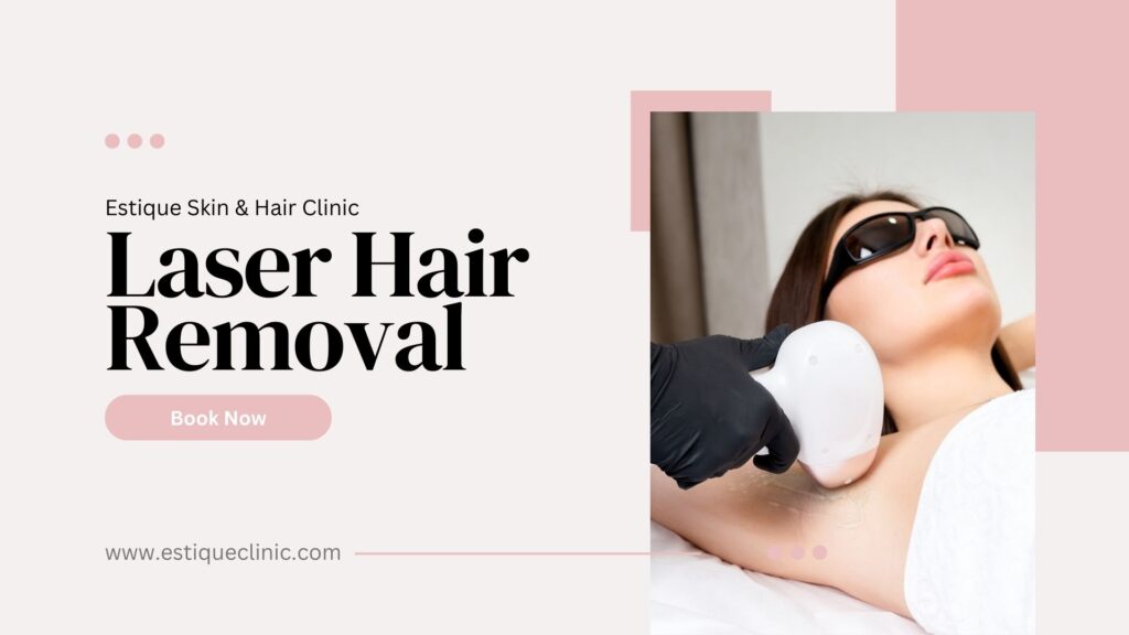 laser hair removal