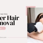 laser hair removal