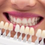 Dental Implants Brunswick