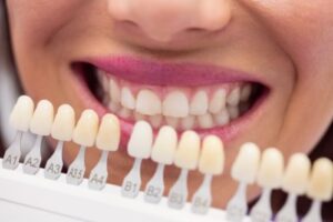 Dental Implants Brunswick