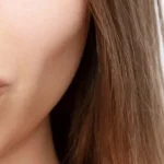 sculptra filler in dubai
