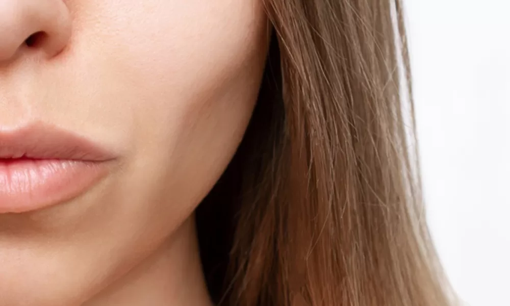 sculptra filler in dubai