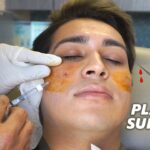 Plastic Surgery Nurse After Care