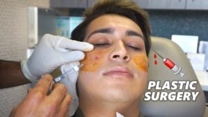 Plastic Surgery Nurse After Care