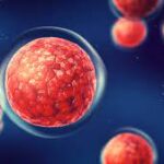 stem cell therapy