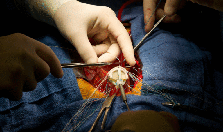 Aortic Valve Replacement Devices Market (1)