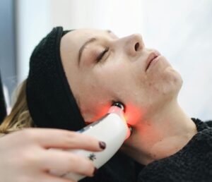 Dubai Laser Scar Surgery: How It Works & Recovery Tips