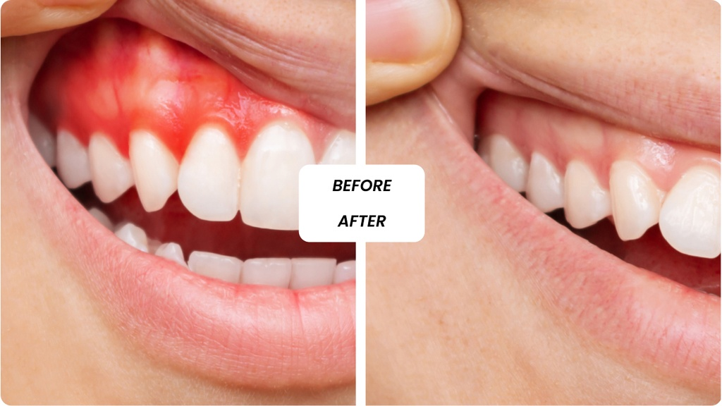 General Dentistry in Dubai