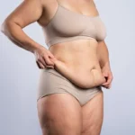 Mommy-Makeover-Surgery