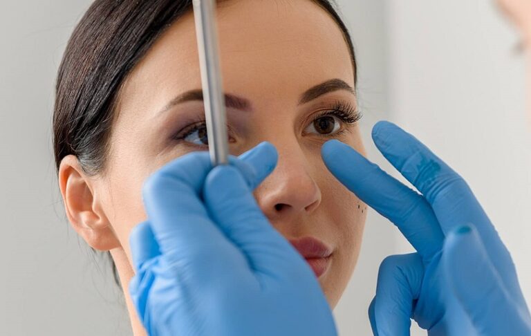 Rhinoplasty in Dubai Recovery Timeline and Care Tips