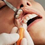 Top Dental Clinic in Dubai for Professional Teeth Cleaning