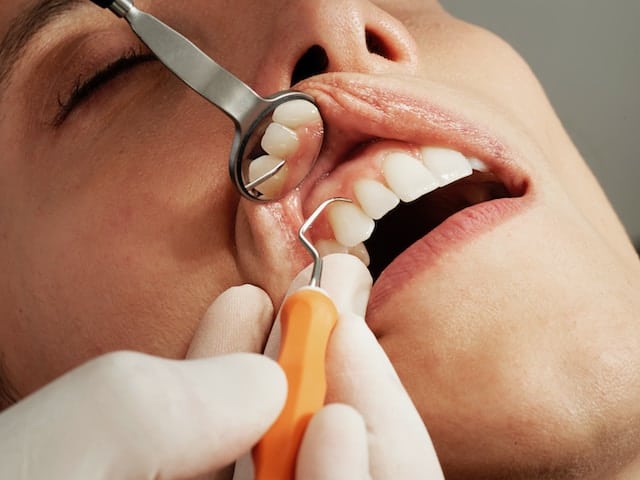 Top Dental Clinic in Dubai for Professional Teeth Cleaning