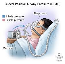 BiPAP Mask in Karachi | Raza Corporation