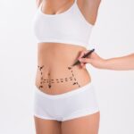 lipo2
