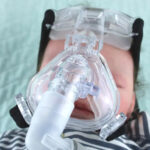 Bronchopulmonary Dysplasia