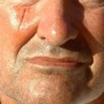 Best Rated Plastic Surgeons for Facial Scars Dubai