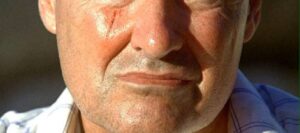 Best Rated Plastic Surgeons for Facial Scars Dubai