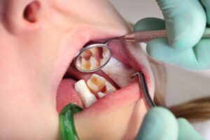 Dental Problems - adp
