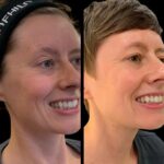 Best Aesthetic Clinics in dubai