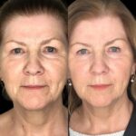 Best Aesthetic Clinic in dubai