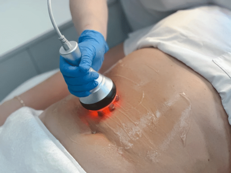 Slimmer Silhouette with Laser Liposuction in Dubai