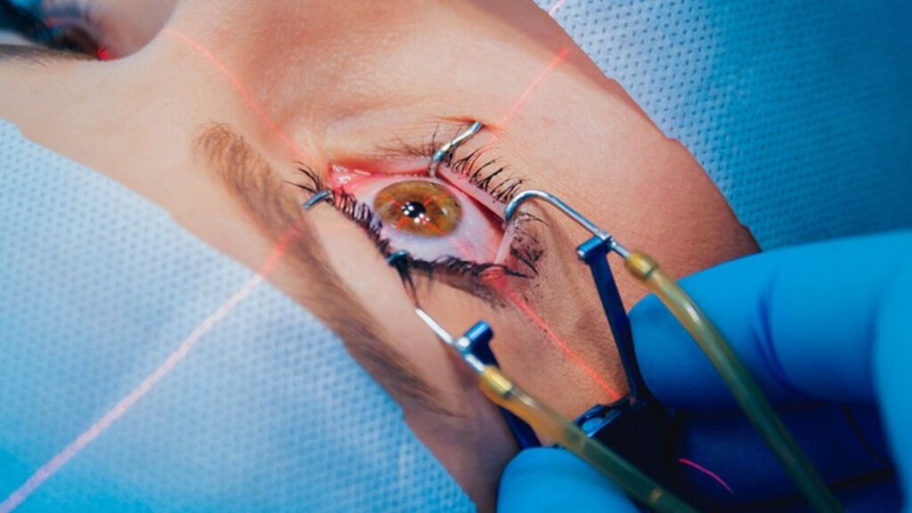 femto-lasik-1300x731