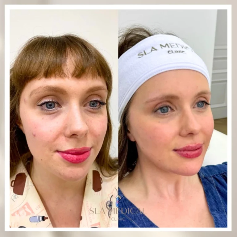 Ipl Laser In Manchester