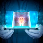 peyronie's disease treatment