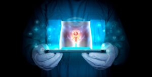 peyronie's disease treatment