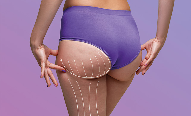 Butt Fat Transfer in Dubai