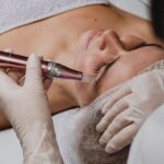 Dubai Dermapen Treatment for Fast Visible Results