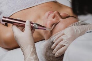 Dubai Dermapen Treatment for Fast Visible Results