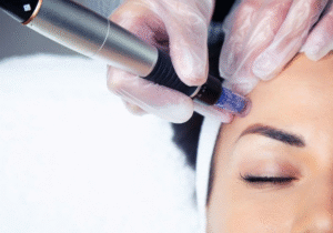 Dubai Dermapen Treatment for Ultra Smooth Texture