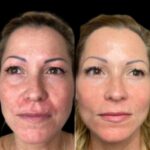 Best Plastic Surgeon in dubai