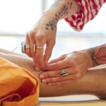 Acupuncture for Health Philadelphia