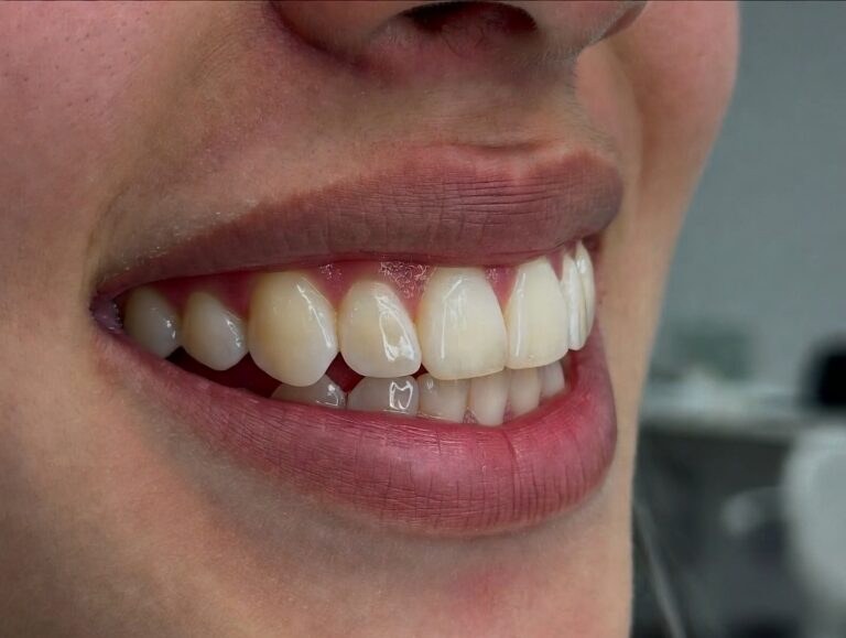 How Orthodontics Improves Smile Aesthetics