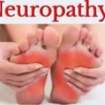 Neuropthay-link-for-website-compressed-250x200.jpg