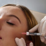 botox treatment for face